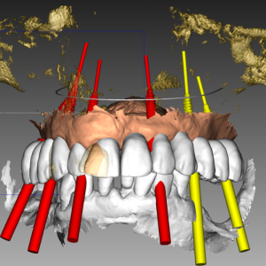 odontoiatria digitale - laboratorio odontotecnico